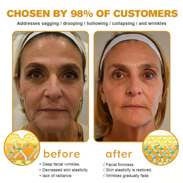 👨‍⚕️ Made and Shipped from US✅ Botox Bee Venom Wrinkle Removal Cream- 49% OFF