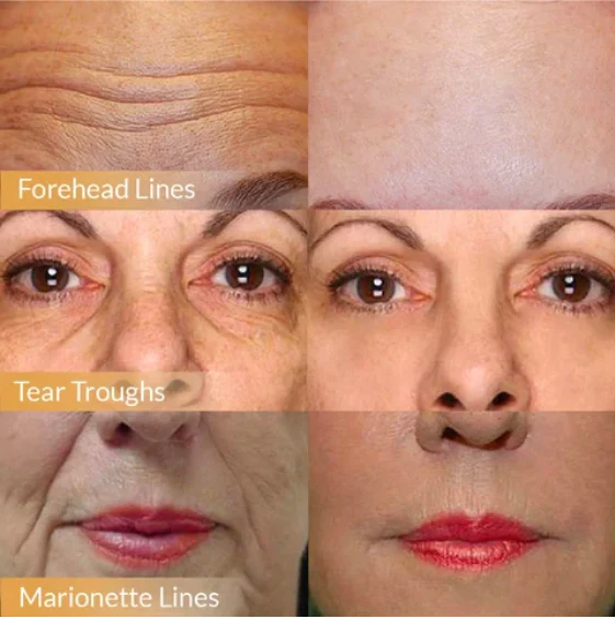 POLYPEPTIDE FIRMING FULL FACE CREAM ✨ Witness a Change for Beautiful Skin Within 2 Weeks! 🌟🧴