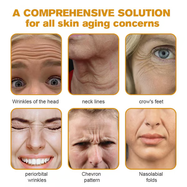 👨‍⚕️ Made and Shipped from US✅ Botox Bee Venom Wrinkle Removal Cream- 49% OFF