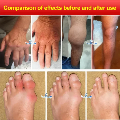 ⚡️ Ventilation Buster: Powerful Japanese Sour Wind Plaster Instant Relief, Imported from Japan! 🇯🇵